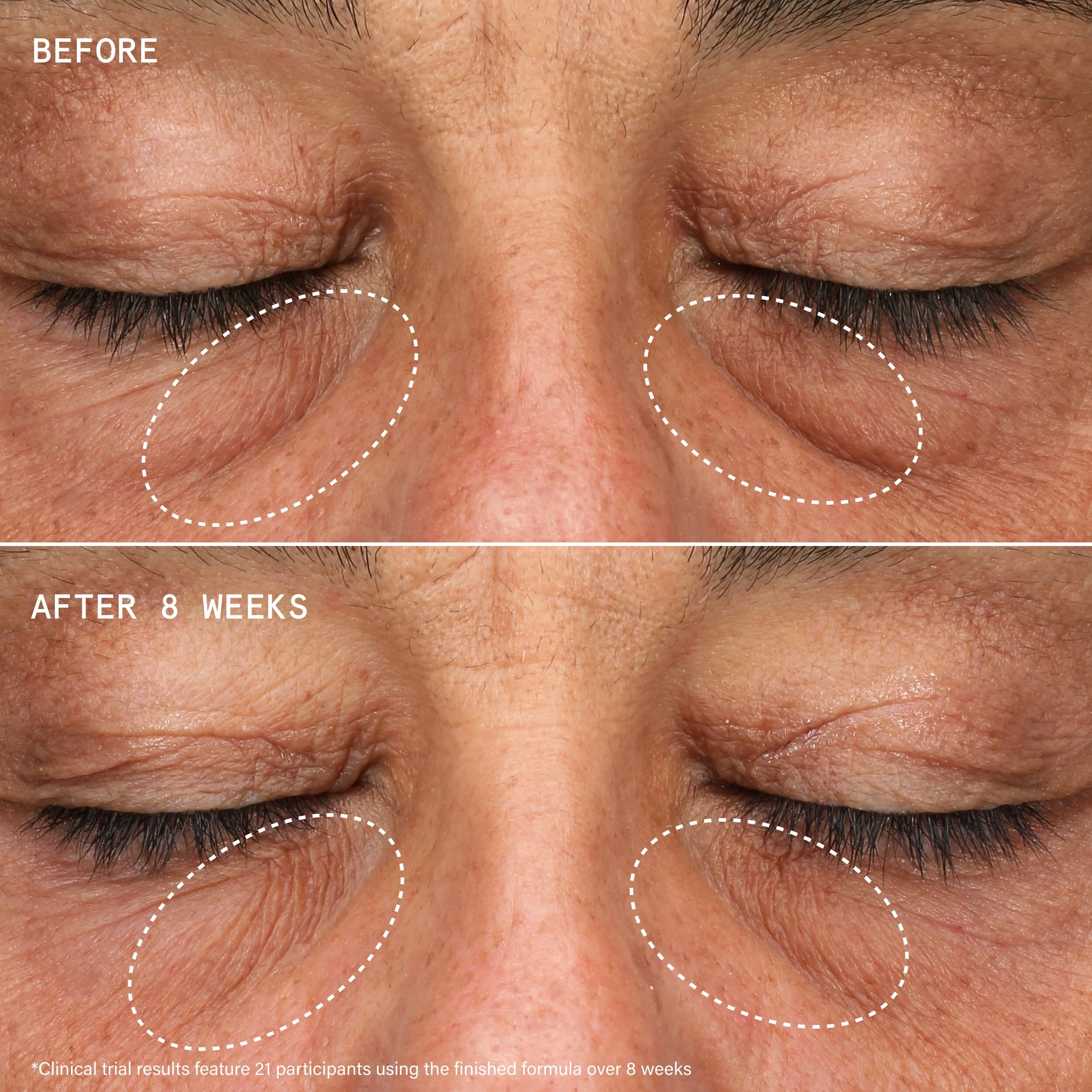 Super Healthy Skin Über Youth Eye Energy Cream for Puffiness and Dark Circles