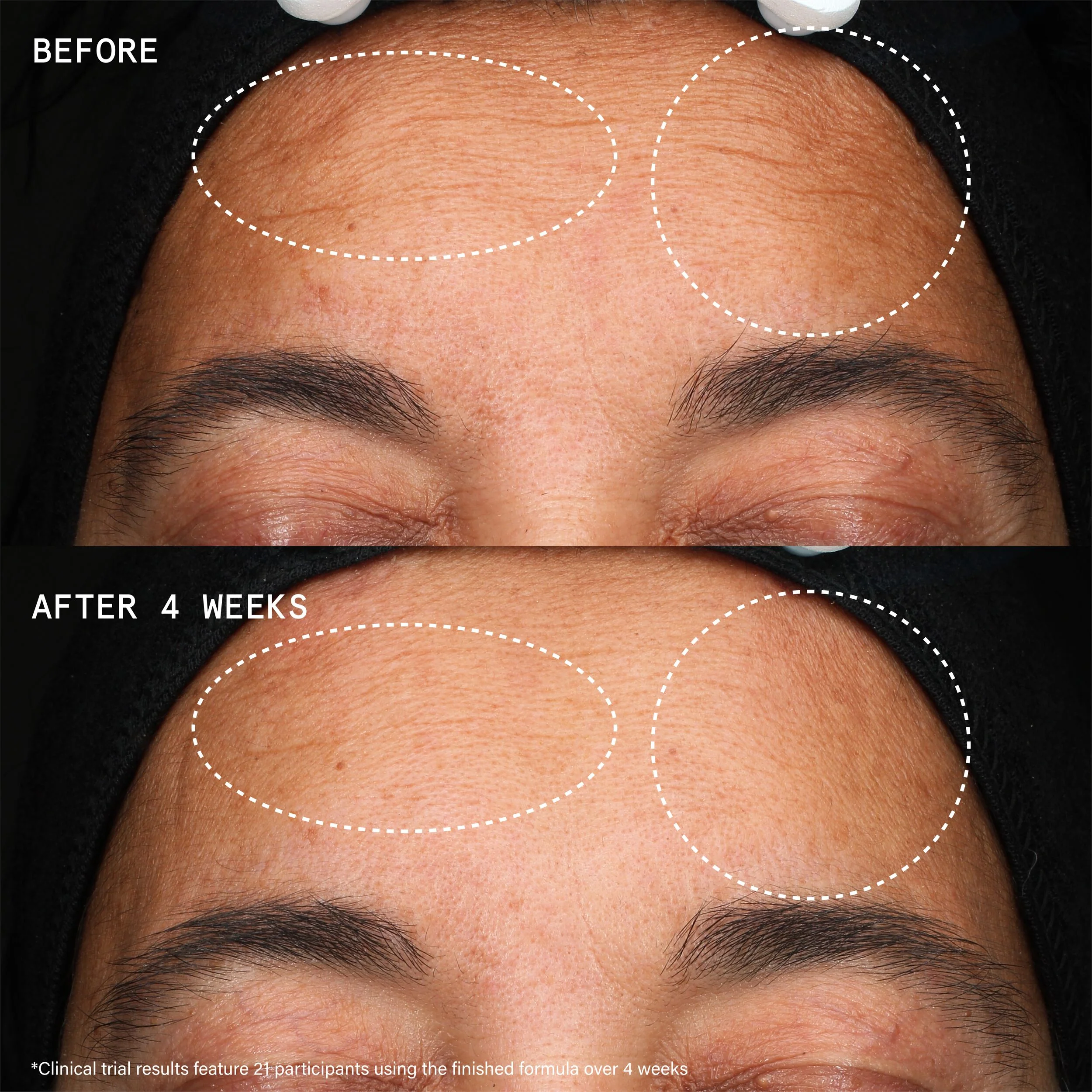Youthbomb Extreme Retinal Serum med 5% retinoid, retinal och Bio-Bakuchiol Complex