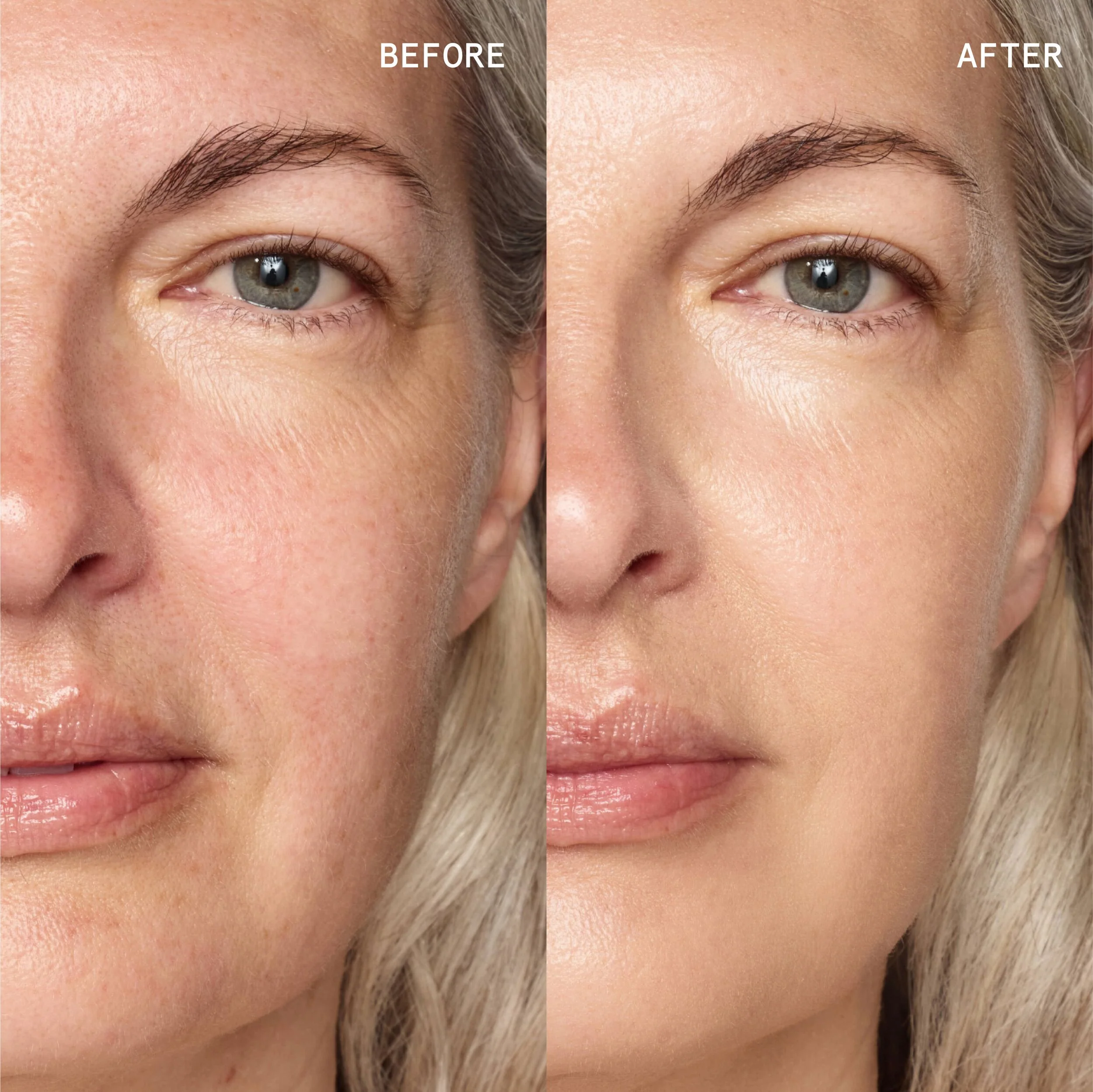 Superluminously getint glow serum met hyaluronzuur